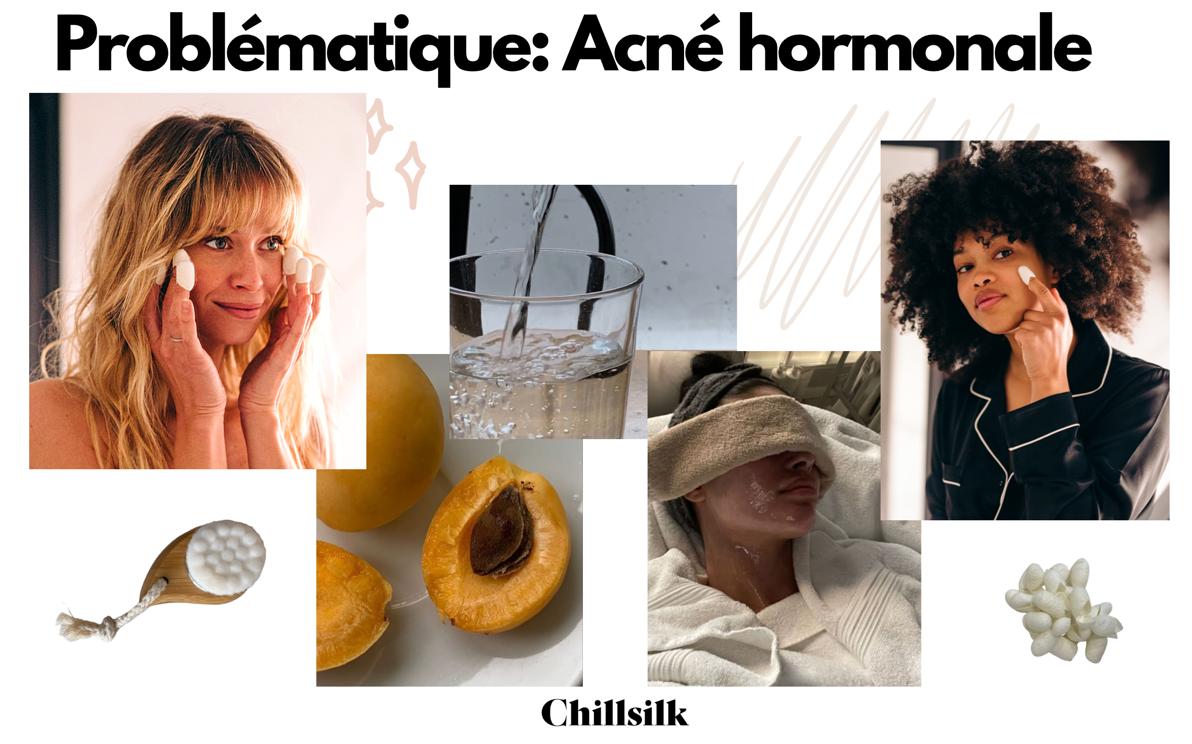 Comment limiter l’acné hormonale ?
